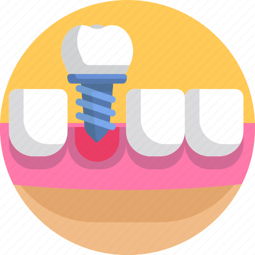 Dental, artificial, dental implants, dentistry, implant, medical, tooth icon - Download on Iconfinder