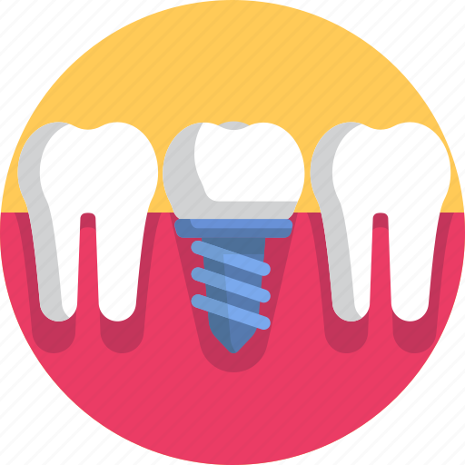 Dental, dental implant, dentist, dentistry, root canal, dental treatment, tooth icon - Download on Iconfinder