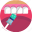 dental, dentist, dentistry, gum, injection, teeth, tooth 