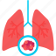 lung, cancer, body, human, anatomy, lungs 