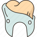 tooth, enamel, loss, dental, problem