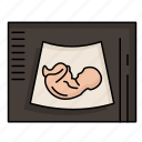 baby, maternity, pregnancy, sonogram, ultrasound