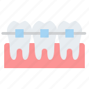braces, dental, tooth, dentistry
