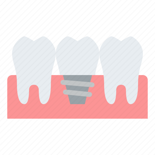 Dental, implant, treatment, healthcare icon - Download on Iconfinder