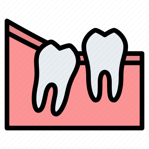 Wisdom, teeth, partial, eruption, dental, gum icon - Download on Iconfinder