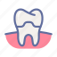 crown, dental, dentist, medical, oral, tooth 