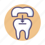 crowning, dental, dental crown, tooth, tooth crown 