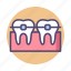 braces, dental, dental braces, metal braces 