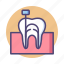 canal, root, root canal, teeth, tooth 