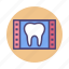 dental, tooth, x ray, xray 