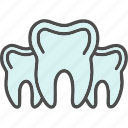 braces, teeth, tooth, dental, dentist