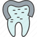 dental, treatment, dentist, gum, gums, tooth, root, canal