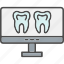 dental, monitor, mouth, tooth, scan 
