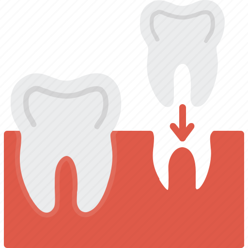 Dental, implants, denture, prosthesis, treatment icon - Download on Iconfinder