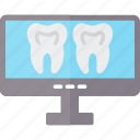 dental, monitor, mouth, tooth, scan