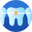 braces, care, dental, dentist, healthy, mouth, orthodontic 