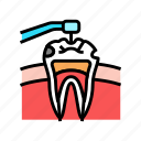 caries, treatment, dental, care, dentist, tooth