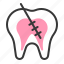 dental, dentist, dentistry, endodontic, root canal, tooth, treatment 
