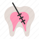 dental, dentist, dentistry, endodontic, root canal, tooth, treatment