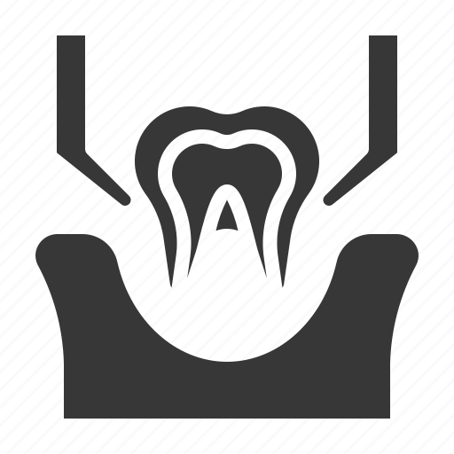 Dental, dentist, dentistry, healthcare, tooth, tooth extraction icon - Download on Iconfinder