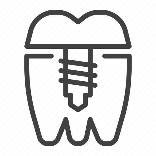 Dental, implant, tooth, treatment icon - Download on Iconfinder