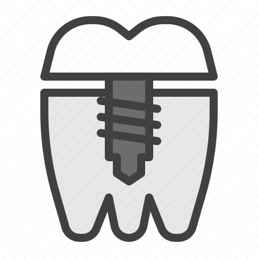 Dental, implant, tooth, medical icon - Download on Iconfinder