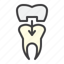 dental, tooth, crown, treatment