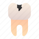 cavity, caries, decay, tooth