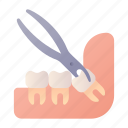 extraction, molar, tooth, dentist