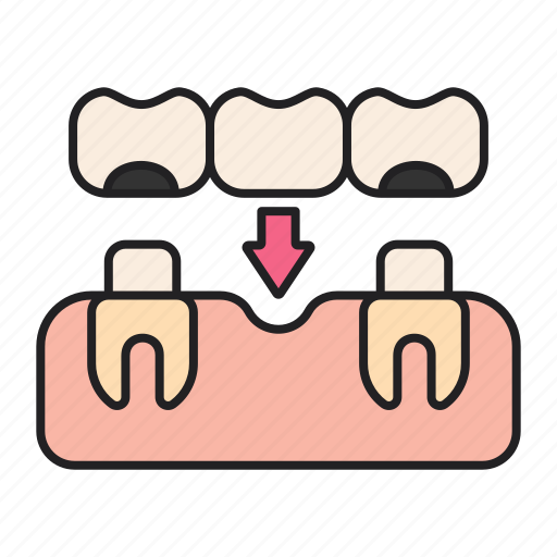 Bridge, implant, dentist, tooth icon - Download on Iconfinder