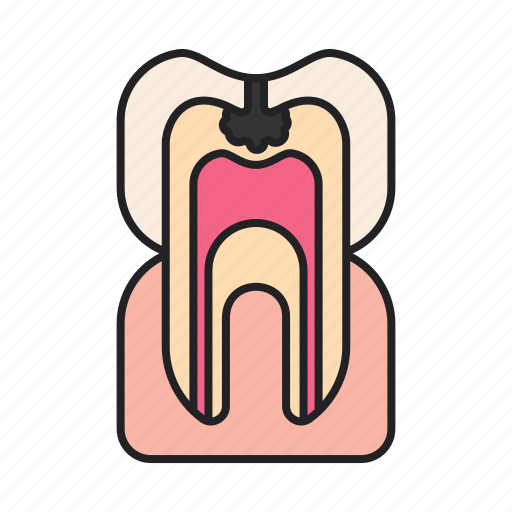 Caries, cavity, decay, tooth icon - Download on Iconfinder