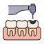 cavity, handpeace, tooth, dentist 