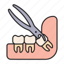 extraction, molar, tooth, dentist