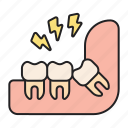 pain, molar, tooth, dentist