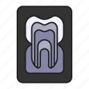 x, ray, tooth, dentist, dental