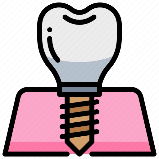 Dental, dentist, implant, teeth, tooth icon - Download on Iconfinder