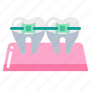 braces, dental, dentist, teeth, tooth