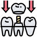 cap, crown, dental, implant, tooth