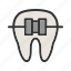 tooth, with, braces 