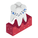 tooth bonding, dental bonding, tooth, teeth, dentistry