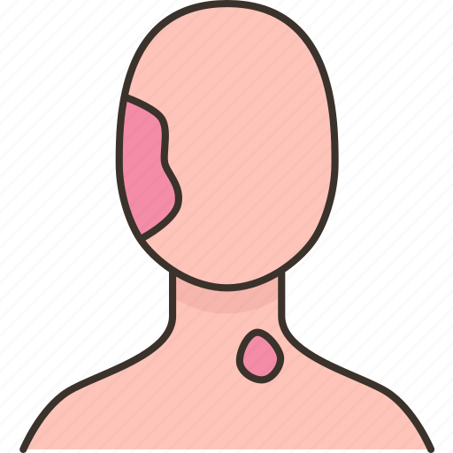 Birthmark, skin, mole, melanoma, dermatology icon - Download on Iconfinder