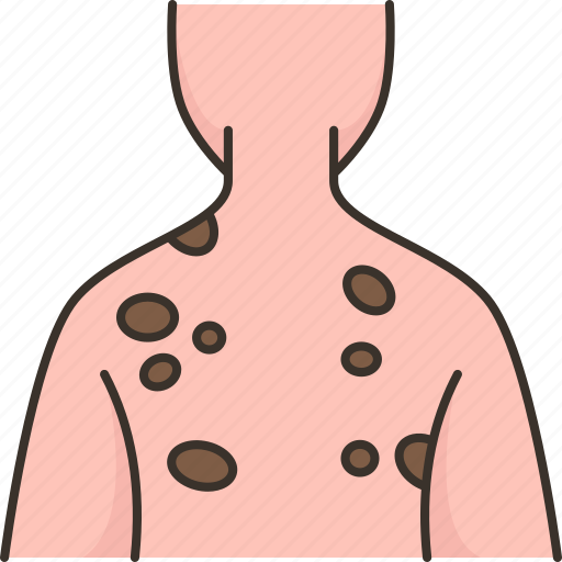 Skin, cancer, melanoma, body, health icon - Download on Iconfinder