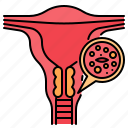 cervical, cancer, disease, test, uterus, medical, female
