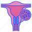 cervical, cancer, disease, test, uterus, medical, female 