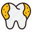 caries, teeth, tooth, dental, mouth, molar, bacteria 