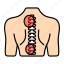 slipped disc, backache, spine pain, herniated disc, herniation pain, spinal cord, lower back injury, lower back pain 