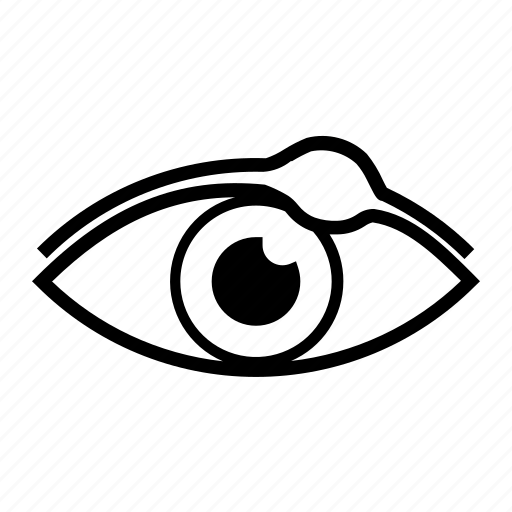 Conjunctivitis, eye disease, eye problems, stye, eyes icon - Download on Iconfinder