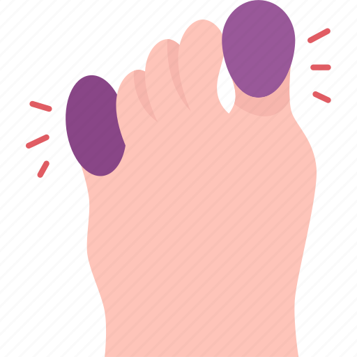 Foot, toe, bruise, swelling, pain icon - Download on Iconfinder