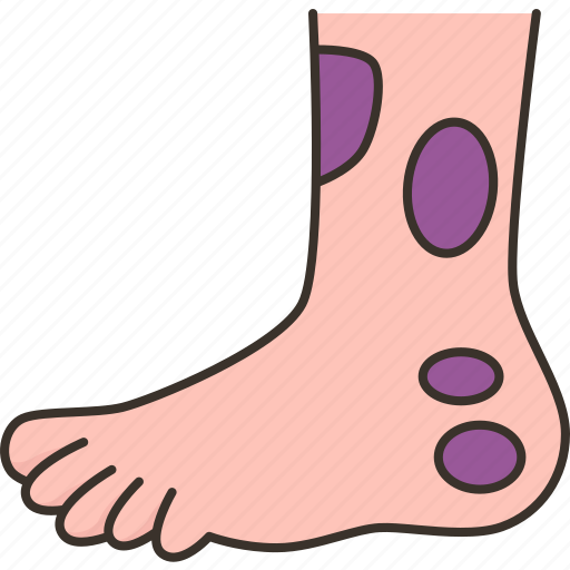 Bruise, stone, heel, foot, pain icon - Download on Iconfinder