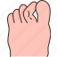 toe, claw, joint, deformity, bend 